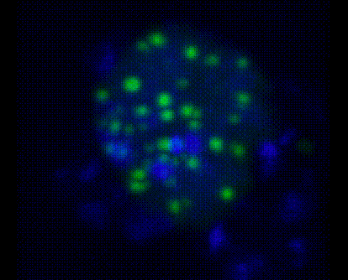 Ac5-E45K-Dan-GFP