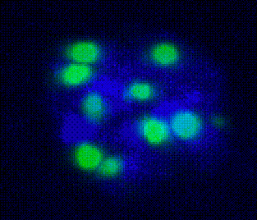 Ac5-ESTLR-Dan-GFP in 3D